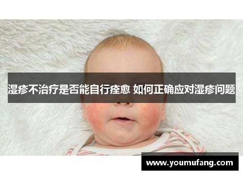 湿疹不治疗是否能自行痊愈 如何正确应对湿疹问题